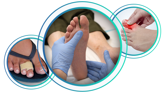 Hammertoe Treatment - Island Foot Clinics