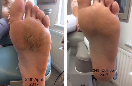 Swift Before and After 3