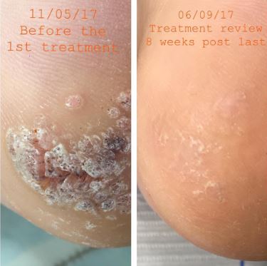 Swift Before and After 4